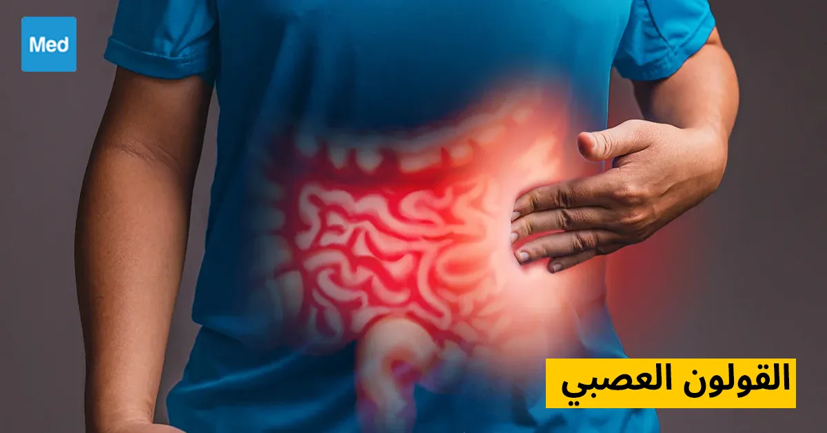 القولون العصبي